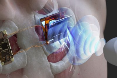 Electrónica en Dispositivos Médicos Implantables