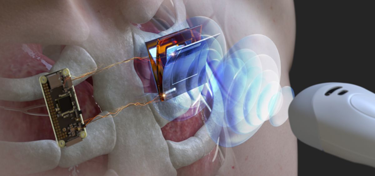 Electrónica en Dispositivos Médicos Implantables